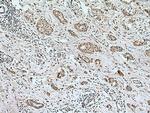 PPM1B Antibody in Immunohistochemistry (Paraffin) (IHC (P))