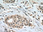 PPM1B Antibody in Immunohistochemistry (Paraffin) (IHC (P))