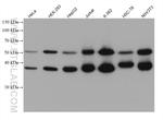 PPM1B Antibody in Western Blot (WB)