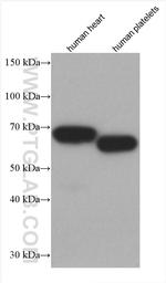 PDLIM5 Antibody in Western Blot (WB)