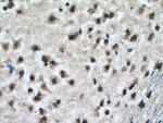 RAB18 Antibody in Immunohistochemistry (Paraffin) (IHC (P))