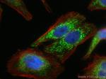 ETFA Antibody in Immunocytochemistry (ICC/IF)