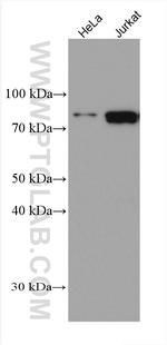 PRMT7 Antibody in Western Blot (WB)