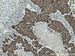 LRPPRC Antibody in Immunohistochemistry (Paraffin) (IHC (P))