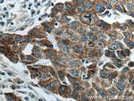 LRPPRC Antibody in Immunohistochemistry (Paraffin) (IHC (P))
