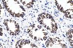 LRPPRC Antibody in Immunohistochemistry (Paraffin) (IHC (P))