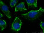 NOX4 Antibody in Immunocytochemistry (ICC/IF)