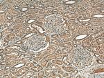 NOX4 Antibody in Immunohistochemistry (Paraffin) (IHC (P))