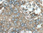 RPS12 Antibody in Immunohistochemistry (Paraffin) (IHC (P))