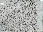 ANP32A Antibody in Immunohistochemistry (Paraffin) (IHC (P))