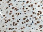 ANP32A Antibody in Immunohistochemistry (Paraffin) (IHC (P))