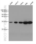 ANP32A Antibody in Western Blot (WB)