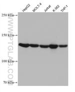 ESYT1 Antibody in Western Blot (WB)