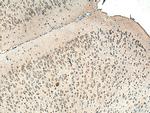 ALPK1 Antibody in Immunohistochemistry (Paraffin) (IHC (P))