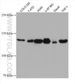 ALPK1 Antibody in Western Blot (WB)