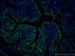 FABP2 Antibody in Immunohistochemistry (Paraffin) (IHC (P))