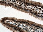 FABP2 Antibody in Immunohistochemistry (Paraffin) (IHC (P))