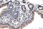 FABP2 Antibody in Immunohistochemistry (Paraffin) (IHC (P))