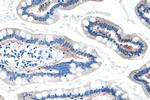 FABP2 Antibody in Immunohistochemistry (Paraffin) (IHC (P))