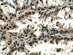 PSMA6 Antibody in Immunohistochemistry (Paraffin) (IHC (P))