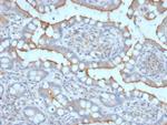 StAR (Steroidogenic Acute Regulator) (Leydig Cell Marker) Monoclonal Antibody (STAR/2077)