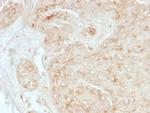 StAR (Steroidogenic Acute Regulator) (Leydig Cell Marker) Monoclonal Antibody (STAR/3976)