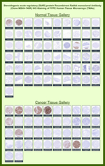 StAR (Steroidogenic Acute Regulator) (Leydig Cell Marker) Recombinant Rabbit Monoclonal Antibody (MSVA-740R)