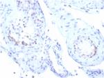 StAR (Steroidogenic Acute Regulator) (Leydig Cell Marker) Recombinant Rabbit Monoclonal Antibody (STAR/3915R)