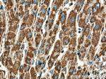 DLD Antibody in Immunohistochemistry (Paraffin) (IHC (P))