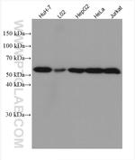 DLD Antibody in Western Blot (WB)