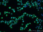 ITK Antibody in Immunocytochemistry (ICC/IF)