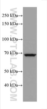 ITK Antibody in Western Blot (WB)