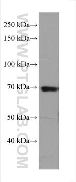 ITK Antibody in Western Blot (WB)