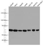 NARS Antibody in Western Blot (WB)