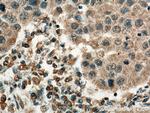 EIF3A Antibody in Immunohistochemistry (Paraffin) (IHC (P))