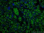 RHAG Antibody in Immunohistochemistry (Paraffin) (IHC (P))
