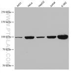 ALIX/AIP1 Antibody in Western Blot (WB)