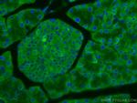 EIF3L Antibody in Immunohistochemistry (Paraffin) (IHC (P))