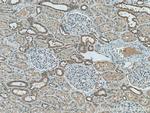 ATG4B Antibody in Immunohistochemistry (Paraffin) (IHC (P))