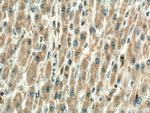TXNRD1 Antibody in Immunohistochemistry (Paraffin) (IHC (P))