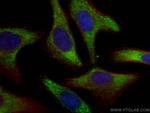RPL6 Antibody in Immunocytochemistry (ICC/IF)