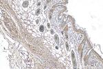ZNF217 Antibody in Immunohistochemistry (Paraffin) (IHC (P))
