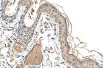ZNF217 Antibody in Immunohistochemistry (Paraffin) (IHC (P))
