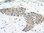 CAPN1 Antibody in Immunohistochemistry (Paraffin) (IHC (P))