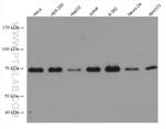 METTL3 Antibody in Western Blot (WB)