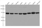 CTPS2 Antibody in Western Blot (WB)