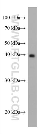 AgBR1 Antibody in Western Blot (WB)