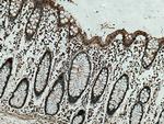 PSMB9 Antibody in Immunohistochemistry (Paraffin) (IHC (P))