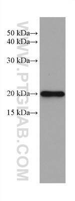 PSMB9 Antibody in Western Blot (WB)