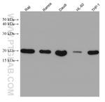 PSMB9 Antibody in Western Blot (WB)